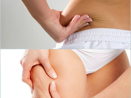 ESTÉTICAnews | Síndrome da Desarmonia Corporal? (DSC)