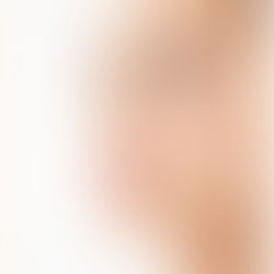 PREENCHEDORES FACIAIS