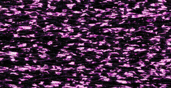 Rainbow Gallery Petite Treasure Braid PB90 Festive Fuchsia