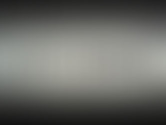 Hysteria and the beginning of psychoanalysis