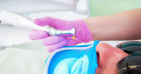 Root Canal Treatment_edited.jpg