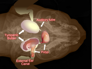 Aural (Ear) Polyps