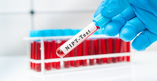 Xét Nghiệm NIPT Có Phải Là Chính Xác Nhất Để Tầm Soát Thai Kỳ Không?