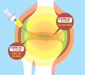 多血小板血漿(PRP)を用いた再生治療を開始しました!