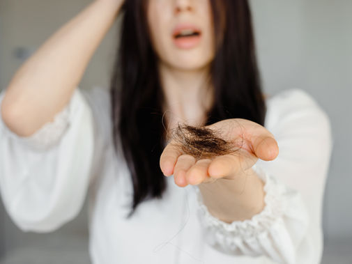 Hair Loss in Women