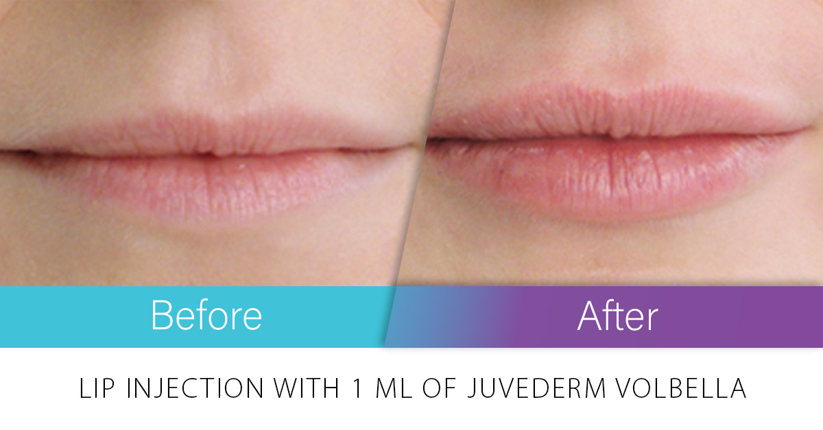 EdithAnidjar Clincal Dermatology