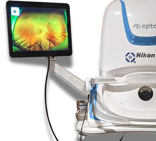 Optos retinal imaging