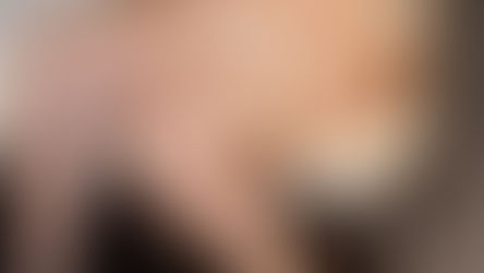 Lipedema: o que é, como identificar os sinais e quando procurar ajuda