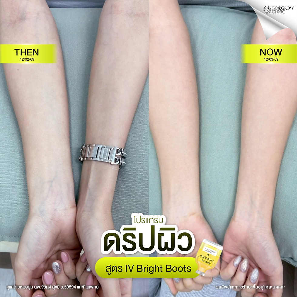 Before-and-after clinic ad showing two pairs of clasped hands and legs on a couch, labeled THEN and NOW, with Thai text.