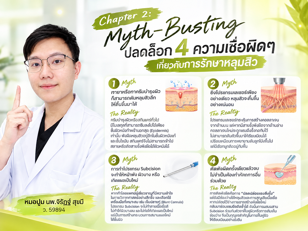 Doctor in white coat points beside Thai poster: Chapter 2 Myth-Busting on acne treatment myths, with four illustrated panels.