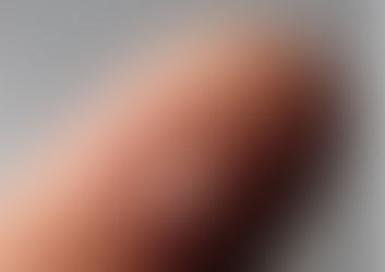 Is it possible for lens replacement surgery to correct both vision and eye health issues?