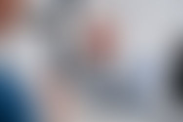 The latest YAG capsulotomy technology