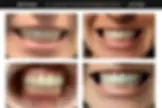 Lakeview Smiles - Best Dentist in Chicago, Illinois