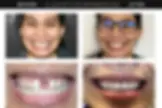 Lakeview Smiles - Best Dentist in Chicago, Illinois