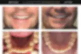 Lakeview Smiles - Best Dentist in Chicago, Illinois