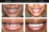Lakeview Smiles - Best Dentist in Chicago, Illinois