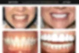 Lakeview Smiles - Best Dentist in Chicago, Illinois