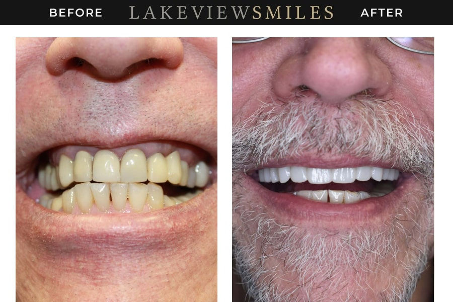 Lakeview Smiles - Best Dentist in Chicago, Illinois