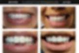 Lakeview Smiles - Best Dentist in Chicago, Illinois