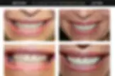 Lakeview Smiles - Best Dentist in Chicago, Illinois