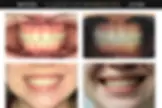 Lakeview Smiles - Best Dentist in Chicago, Illinois