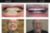 Lakeview Smiles - Best Dentist in Chicago, Illinois