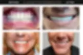 Lakeview Smiles - Best Dentist in Chicago, Illinois