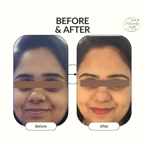 Thumbnail: Whitening Cream Online Shopping Dubai Naturally Number One