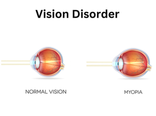 Revolutionary Myopia Management Strategies for Children Every Parent Should Know