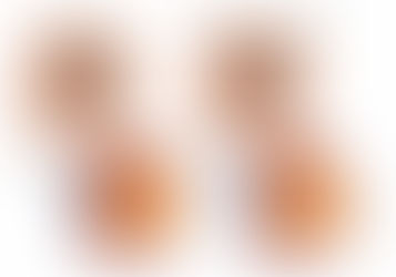 EYES WITH CATARACT