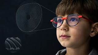 Myopia control