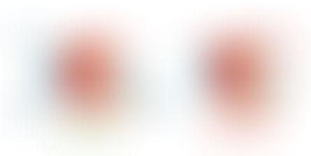 DIABETIC EYE