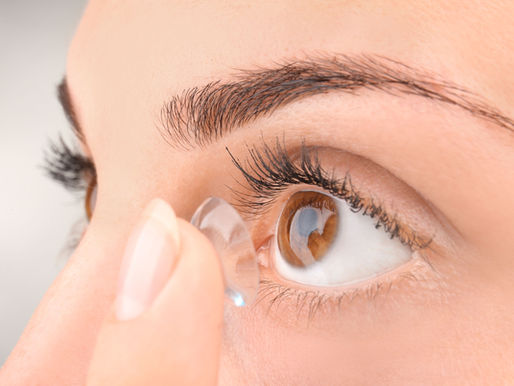 Contact Lenses for Myopia Control