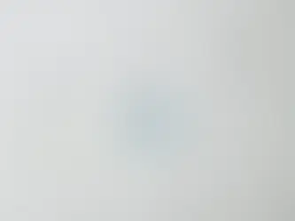 RGP Contact Lenses: Sharp Vision with Long-Term Eye Health Benefits