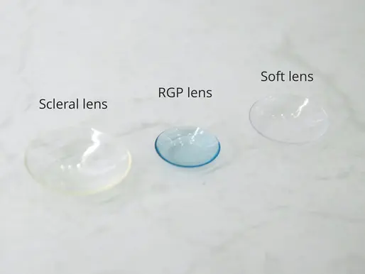RGP Contact Lenses: Sharp Vision with Long-Term Eye Health Benefits