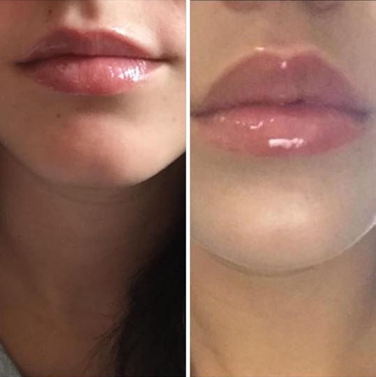 Thumbnail: NU COLOUR® CONTOURING LIP GLOSS SWEET PINK