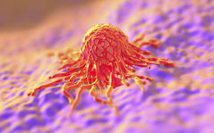 Examining the Efficacy of Ayurveda as an Alternative Treatment for Cancer: Myth or Reality?