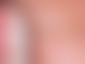 Veneers Done Right: What Patients Should Know Before Any "Smile Makeover"