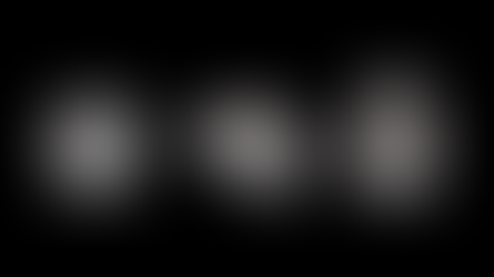 Hirnläsionen auf MRI-Bildern von Patientinnen und Patienten mit Multipler Sklerose