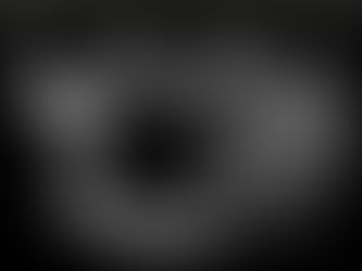 Cisto ovariano em ultrassom transvaginal