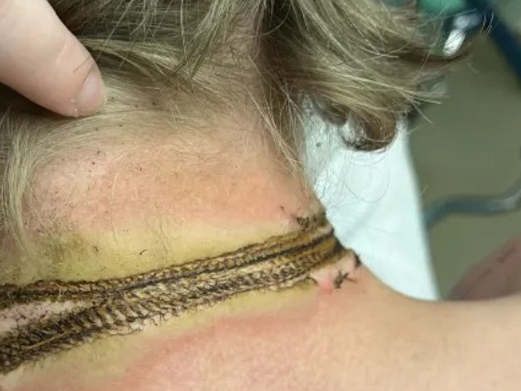 An emrican teenaer was miraculously saved from an electric shock caused by his phone charger.