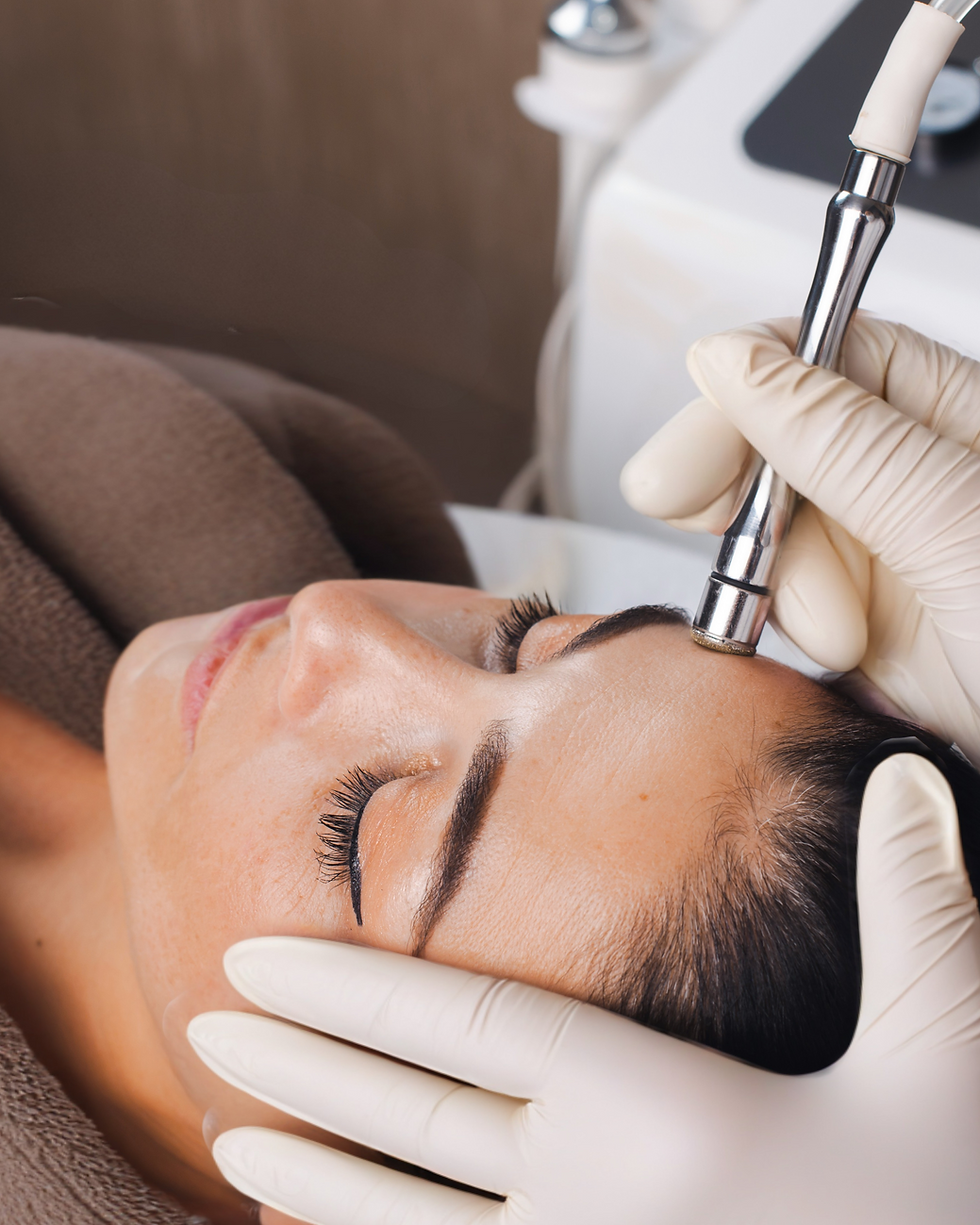 Micro Needling Facial