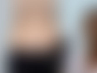 How Affordable Is Liposuction Surgery Near Me?