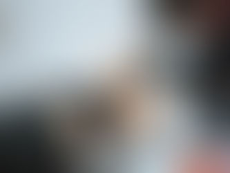 What Are the Benefits of Laser Skin Tightening?