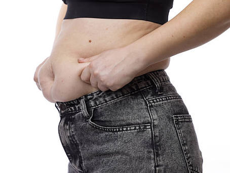 Get a Flatter Stomach with Tummy Tuck Surgery