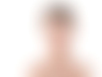 Say Goodbye to Jowls with Neck Lift Surgery