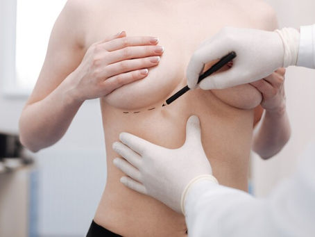 Understanding the Recovery Process After Breast Reduction Surgery