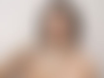 How a Liquid Facelift Restores Volume and Smooths Wrinkles!