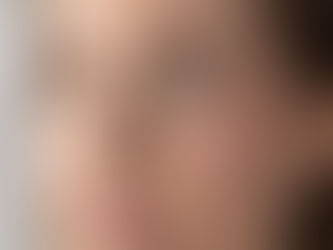 Does Facelift Surgery Leave Visible Scars?