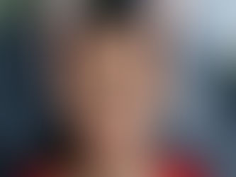 Does Eyelid Surgery Work for Puffy Lower Lids?